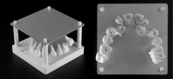 Research Paper: Does 3D Simulation Impact Clinical Reasoning for Orthodontic Treatment Planning of Impacted Axillary Canines?