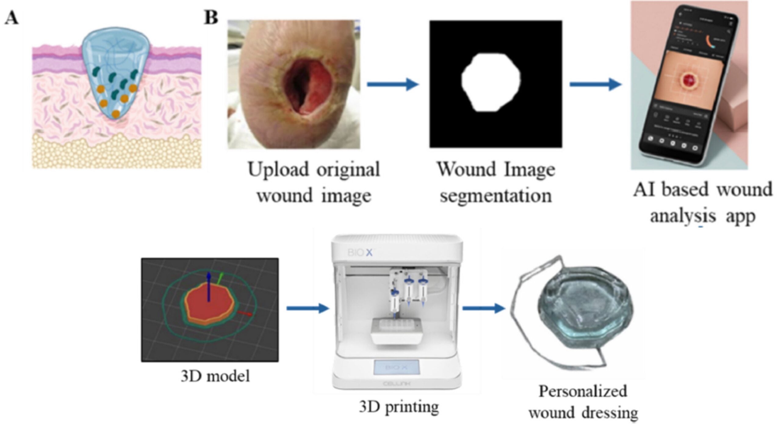 Research Paper: AI-guided 3D Bioprinting of Multi-drug-loaded Chitosan Methacrylate Hydrogels for Personalized Diabetic Ulcer Repair